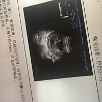 再次确认下，求女孩👧