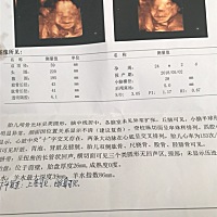 终于把四维做了，看着小孩不像我，男孩女孩都行