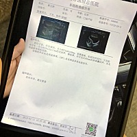 怀孕八周有卵黄囊没胎芽胎心，我该怎么办