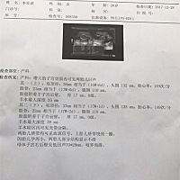 各位美丽的宝妈妈 能不能帮我看看男生女生呀 拜托了