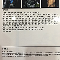 有人能看得懂吗？是男是女啊？今天去照的四维B超.