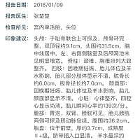 娱乐一下准备要生了帮我看看是男女，