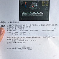 B超单子看男女，谁懂呀？孕31周