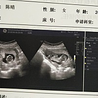 谁会看女宝宝男宝宝