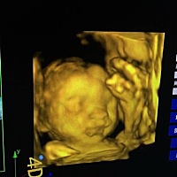 肉嘟嘟的宝宝，不跟妈妈的高鼻梁，跟了丑爸爸的大鼻子，在肚子里好好长哈