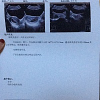 有人说可以看男孩女孩？真的可以看出来吗？