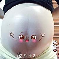 孕31➕2；医生说宝宝偏小一周。我自己也感觉我肚子好小，是不是全都吸收在我身上了啊？已经重了20斤了�...