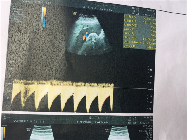 有没有人能帮我看下是男孩还是女孩？30周了，很是好奇