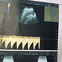 有没有人能帮我看下是男孩还是女孩？30周了，很是好奇