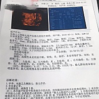 能看出来男孩女孩吗？