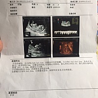 亲们谁会看男孩女孩呀？都喜欢就是比较好奇……