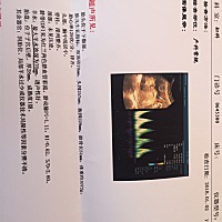 求告知男孩女孩？