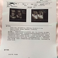 能看出是女宝还是男宝吗？