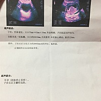 说没有胎心，这个是不是就得听医生的不要宝宝啊？别的都很好