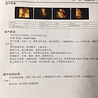 今天刚做的三维，对男孩女孩都喜欢，不过还是很好奇是男宝还是女宝，有懂的没