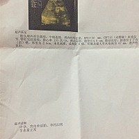 大家懂得看男女的帮我看看是男还是女，谢谢大家帮我看下