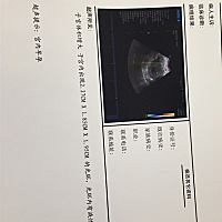 今天见红了，两次了昨天下午开始的，今天比超单子数据是这样的，我得期望又被破没了，如果是女孩真心不...