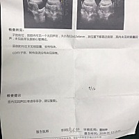 这是宫内孕吗？