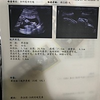 各位宝妈们，帮忙看看是男孩还是女孩呢？^ ^