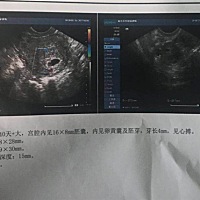 比较好奇 是男是女呀