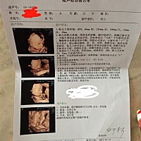 还有二十多天就预产期，好想知道是男宝还是女宝！