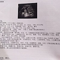 特别想知道男女，虽然男女都一样，哪位大神可以帮忙看看🤗