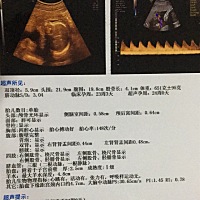 有没有有经验的宝妈看看，是男孩还是女孩？