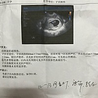 这形状是长的还是圆的？