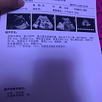 上次四维检查宝宝太小，羊水太少，左心室强光点，吓死了，这个月努力喝水，吃饭，终于都很健康，就是孕...