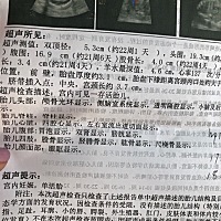 能不能看出男宝女宝啊，之前买的试纸两个都是男宝，好像要个老闺女啊