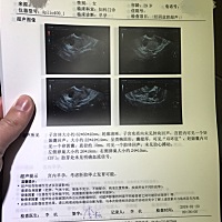 媳妇第一次怀孕，今天再次检查结果是保不了。下周一做手术。祈祷下次一定健健康康，也祝所有宝宝健健康康！
