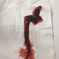 怀孕56天，见红，刚开始是鲜红色的血，今天是黑色的血，每次上厕所就有一股，量和例假后期差不多，现在...