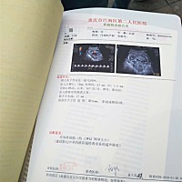 朋友们，帮忙看下怀的是男孩还是女孩？谢谢