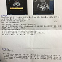 这是23周的彩超单子，有经验的宝妈可以帮我看下是男宝还是女宝呀！好奇中