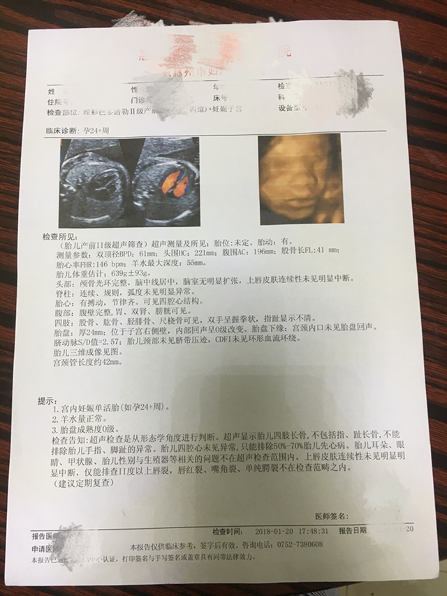 这彩超单看的出是儿子还是女儿吗？