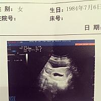 听说这样能看出来男孩女孩、有哪位宝妈帮我看看啊？头胎、怀孕49天做得B超.
