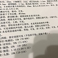 今天做了个四维，好奇心满满的，小棉袄吗？😀😀😀