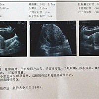 这个尺寸怎么看啊？