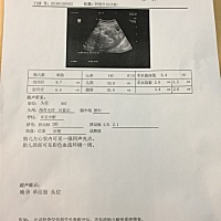 快生了，很好奇是男孩还是女孩