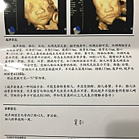 哪位大神能帮看看是男宝宝还是女宝宝吗