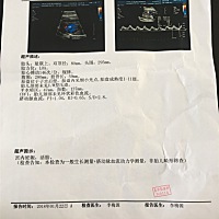 从B超能看的出男宝宝还是女宝宝啊！