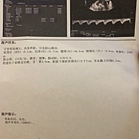 大家帮我看看，男孩女孩😄