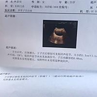 亲亲们帮忙看下b超