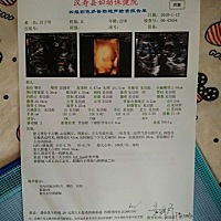 亲们，我这个是男宝宝还是女宝宝