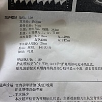 可以顺吗？医生建议剖