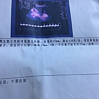 拜托姐妹们帮我看看，孩子健康吗？你们都补充什么营养了？