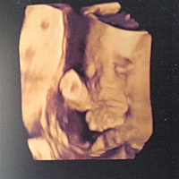 第一张肚里的2宝，第二张是我大儿子的照片，别人都说很像一样的，希望我的2宝能翻盘女宝，给哥哥来个小...