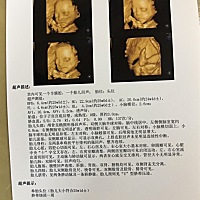 大家帮我看看是男宝还是女宝呀