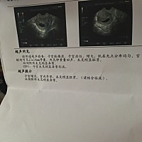 真的很烦特别是拿了报告，孕酮，hcg都降低了，b超也是说没有胎芽，平时月经也不准，我该怎么办，也没有...