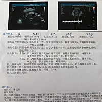 亲们，能看出来男女吗？
